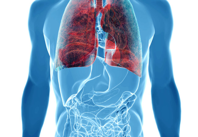 Global Lung Cancer Surgery Market