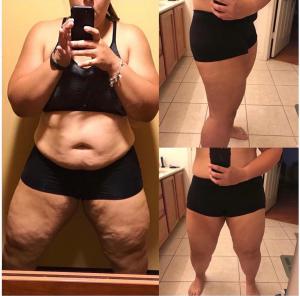Gel-V-Hot-Before-&-After