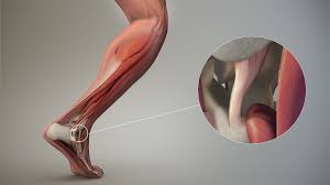 Ligament Stabilizer System Market, market growth, market share, build, grow, bost